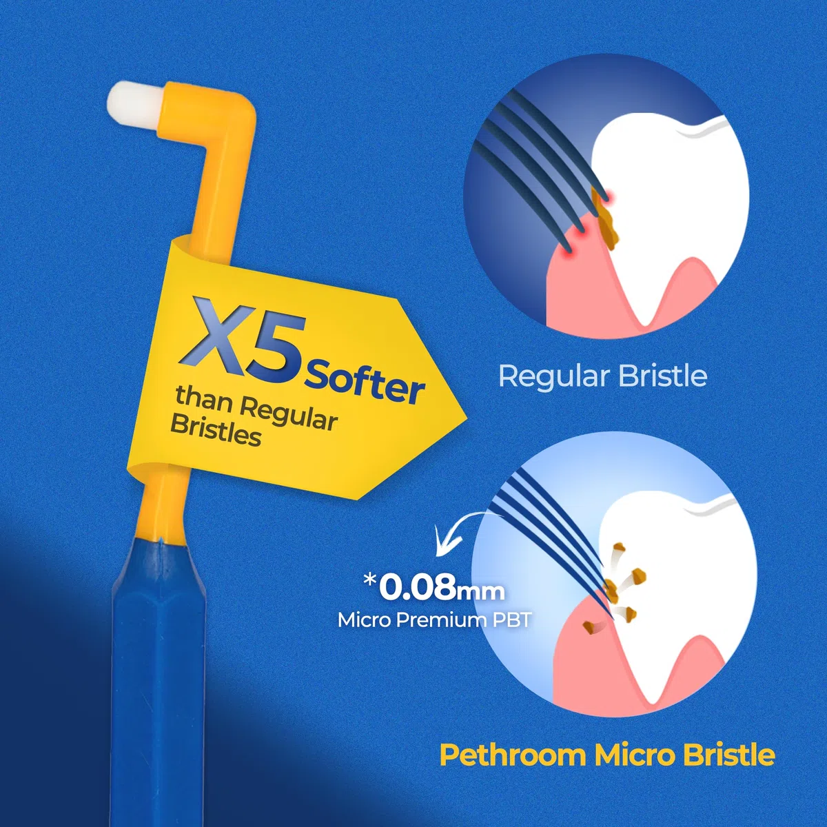 PETHROOM Sala de pesos, gatos, perros, cepillo de dientes, punta profunda, para control centralizado, cabeza redonda, ultraligero, eliminación segura del sarro, ultra pequeño, tamaño XS